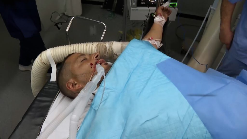 تدهور الوضع الصحي لمراسل الجزيرة إسماعيل أبو عمر