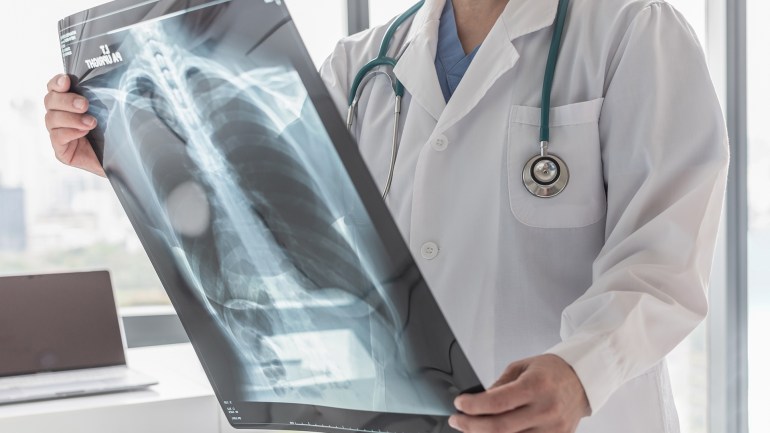 Doctor with radiological chest x-ray film for medical diagnosis on patient's health on asthma, lung disease and bone cancer illness