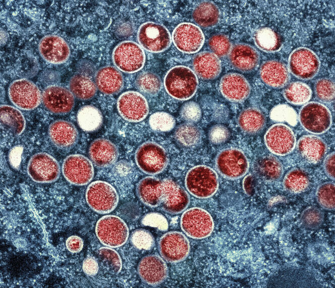 جزيئات Mpox، التي التقطها المعهد الوطني للحساسية والأمراض المعدية (NIAID).