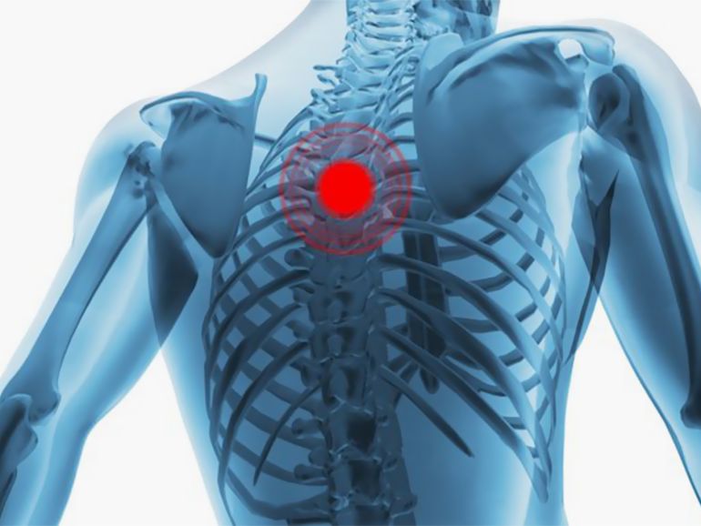 صورة آلام أعلى الظهر