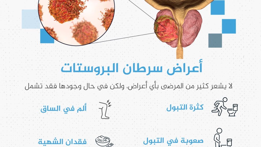 الأطباء مصدومون من عدم اكتشافه مبكرا لديه.. تعرف على سرطان البروستاتا الذي أصاب بايدن