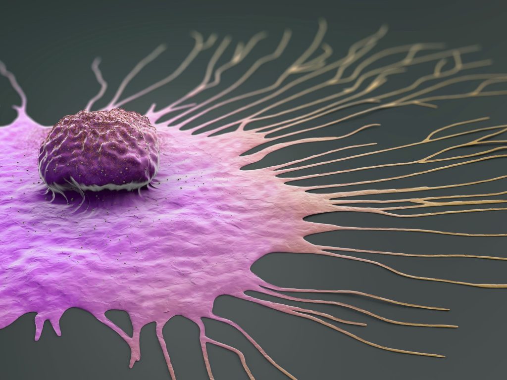 اكتشاف علامة إنذار مبكرة للسرطانات العدوانية