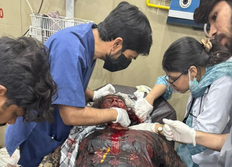 epa12078850 A handout photo made available by the Pakistani military Inter Services Public Relations, shows a person being treated after suffering injuries during a suspected Indian missile attack, at a hospital in Bahawalpur, Pakistan, 07 May 2025. India said it conducted military strikes on nine sites in Pakistan in retaliation for a deadly militant attack on tourists in Kashmir. EPA-EFE/ISPR / HANDOUT HANDOUT EDITORIAL USE ONLY/NO SALES