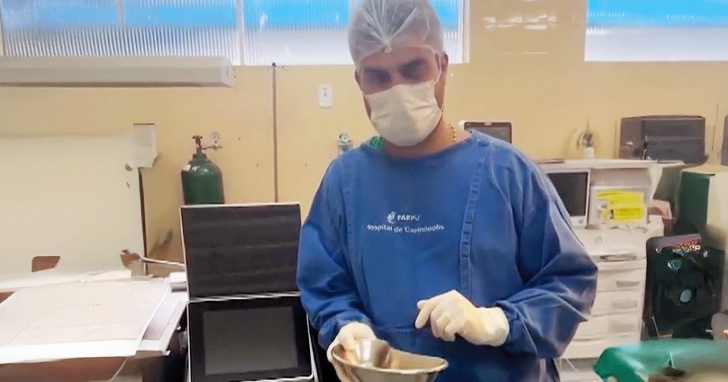 30 حصوة في كلى برازيلي سببها المشروبات الغازية.. ودهشة على المنصات