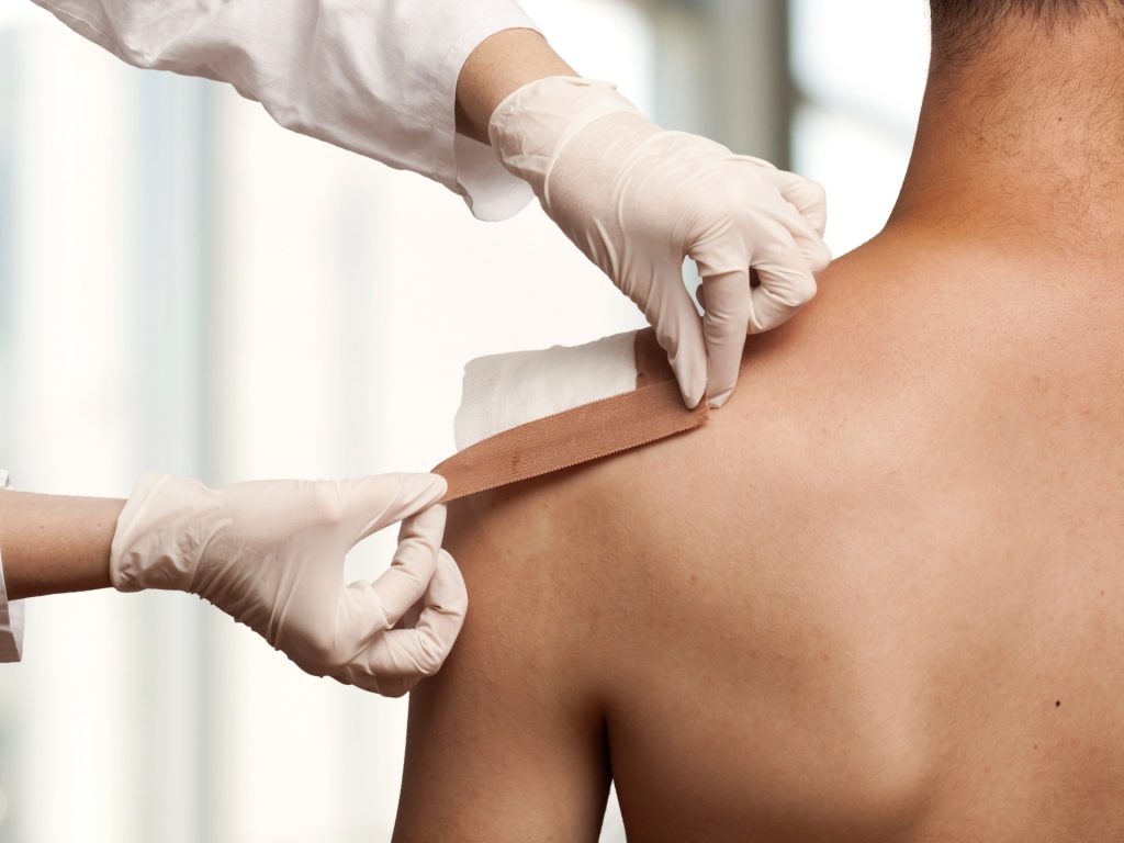 جيل جديد من بدائل الجلد يمنح الأمل لمرضى الحروق