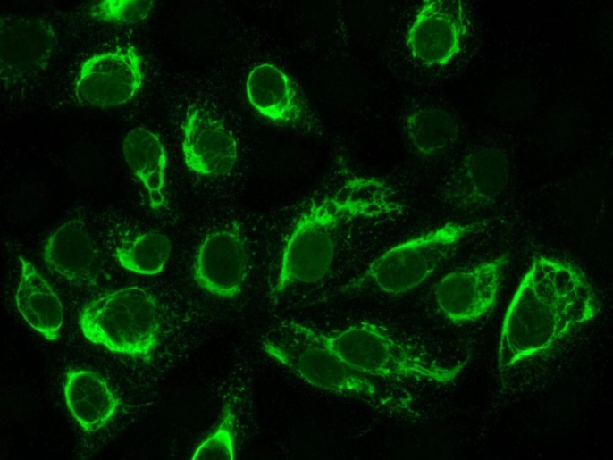 An undated handout picture made available by the Euroimmun AG on 04 February 2016 shows cultured cells that have been infected with the Zika virus in Luebeck, Germany. The cells are located on so-called BIOCHIPs that are then stuck to a microscope slide. The BIOCHIPs are incubated with the patient's blood sample and if antibodies against the virus are found in the patient's blood, the anitbodies will attach themselves to the infected cells - meaning to the viral antigens in the infected cells. The linked antibodies can then be visualized via a fluorescent stain and then detected in a fluorescent microscope. This means that when the infected cells fluoresce - as can be seen in the photo - then antibodies against the Zika virus can be detected in the patients blood sample, indicating a viral infection. (ATTENTION EDITORS: Editorial use only in connection with reporting on the events depicted in the image) EPA/DR. ERIK LATTWEIN/EUROIMMUN AG/HANDOUT