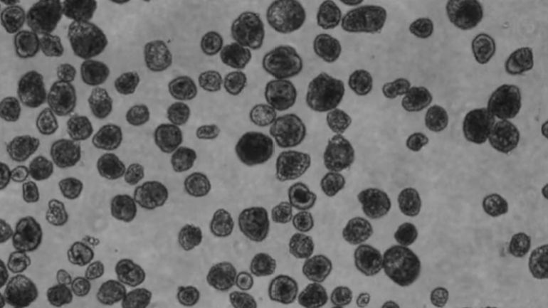 خلايا أصغر بيولوجيا من الخلايا البالغة التي تتكون منها، وهو ما يشير إلى أن عملية التنظيم إلى شكل جديد وحدها كفيلة بإعادة ضبط ساعة الشيخوخة الخلوية (الباحثة جيزيم غوموسكايا)