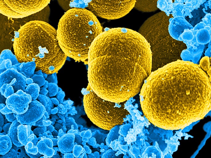 A digitally-colorized scanning electron micrograph depicts a number of mustard-colored, spheroid-shaped Staphylococcus aureus bacteria in the process of escaping their destruction by blue-colored human white blood cells in this undated handout photo. TO MATCH SPECIAL REPORT USA-UNCOUNTED/SURVEILLANCE National Institute of Allergy and Infectious Diseases (NIAID)/Handout via REUTERS ATTENTION EDITORS - THIS IMAGE WAS PROVIDED BY A THIRD PARTY. EDITORIAL USE ONLYEDITORIAL USE ONLY