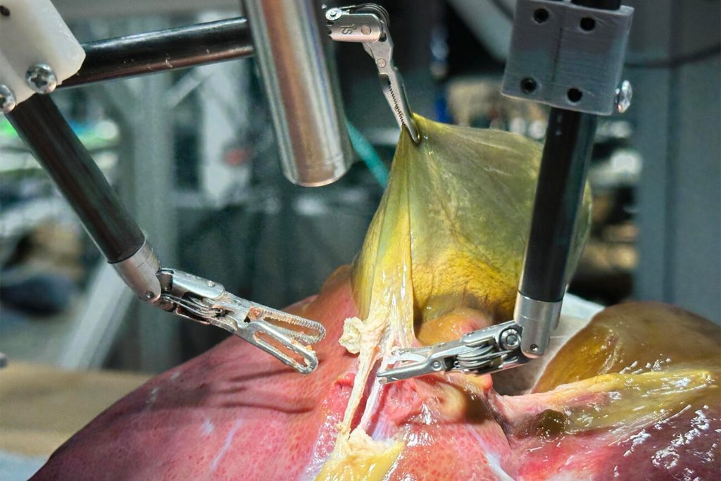 شاهد.. روبوت جراحي يجري أول عملية جراحية دون تدخل بشري