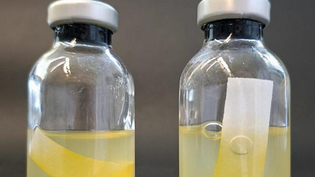 سلاح البكتيريا الخفي.. صبغة صفراء “عجيبة” تصنع الوقود وتقتل الجراثيم