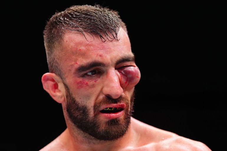 ****داخلية**** ABU DHABI, UNITED ARAB EMIRATES - JULY 26: Mohammad Yahya of the United Arab Emirates reacts after suffering a defeat against Steven Nguyen in a featherweight fight during the UFC Fight Night event at Etihad Arena on July 26, 2025 in Abu Dhabi, United Arab Emirates. (Photo by Chris Unger/Zuffa LLC)