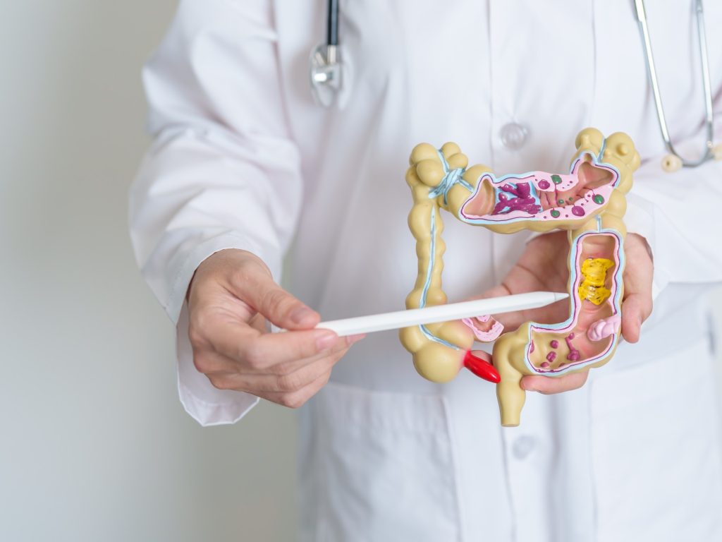 مواليد 1990 أكثر عرضة للإصابة بسرطانات الجهاز الهضمي فما السبب؟