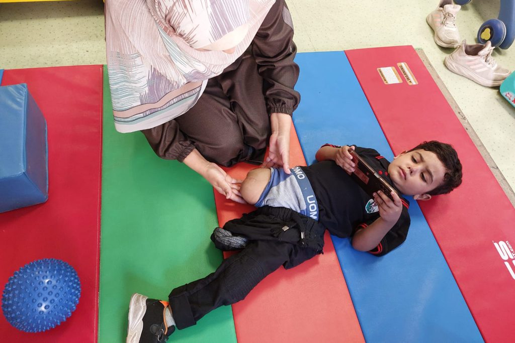 6500 حالة بتر جديدة تضاعف أعباء مستشفى حمد للأطراف بغزة