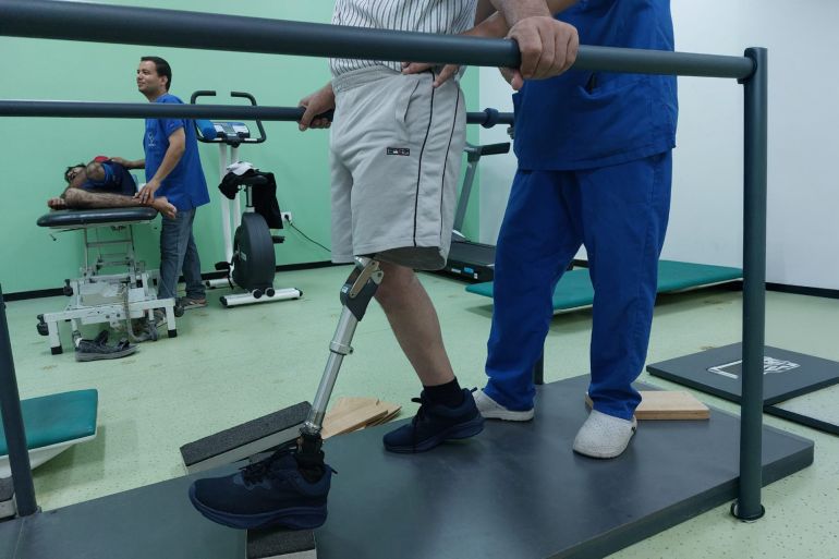 يواصل قسم الاطراف الصناعية تأهيل حالات البتر التي خلفتها الحرب