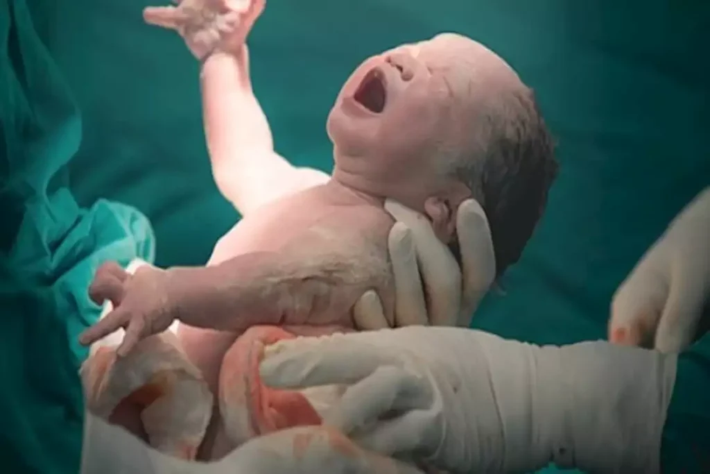 “الصحة”: أدلة استرشادية وحملات مكثفة للحد من الولادة القيصرية