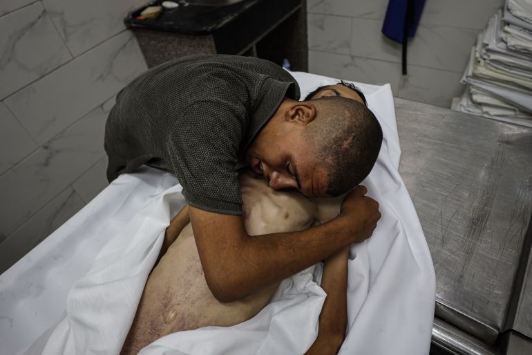 GAZA CITY, GAZA - AUGUST 2: (EDITORS NOTE: Image depicts death) Body of 17-year-old boy named Atif Ebu Hatir, who lost his live due to malnutrition, seen being taken from Al Helou Hospital in Gaza City, Gaza on August 2, 2025. ( Khames Alrefi - Anadolu Agency )