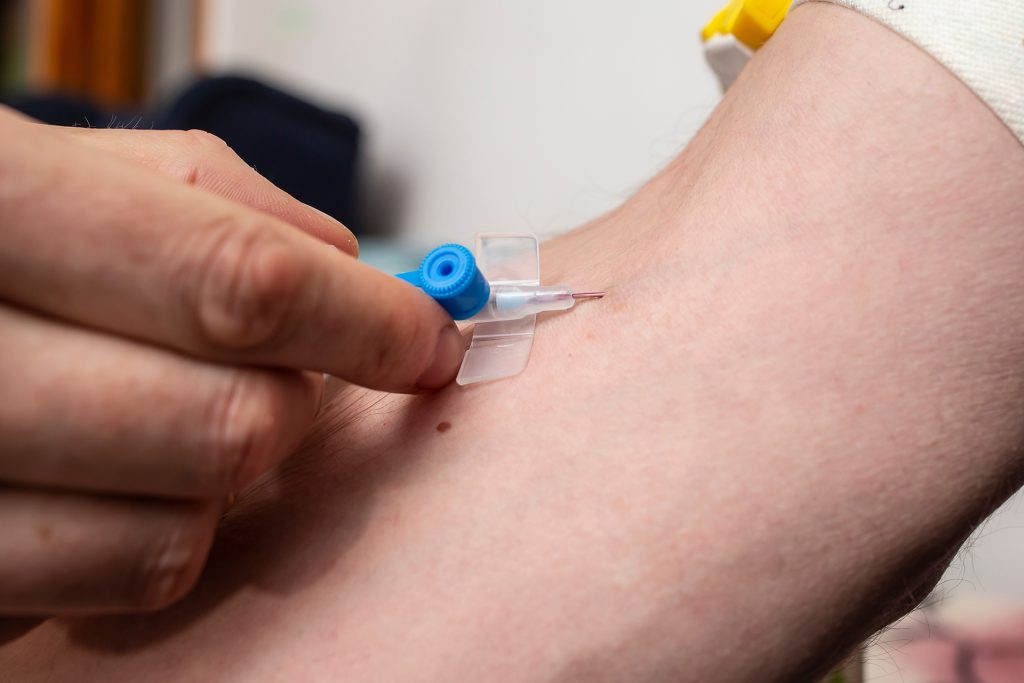 تكنولوجيا جديدة لتسريع الحقن الوريدي البطيء