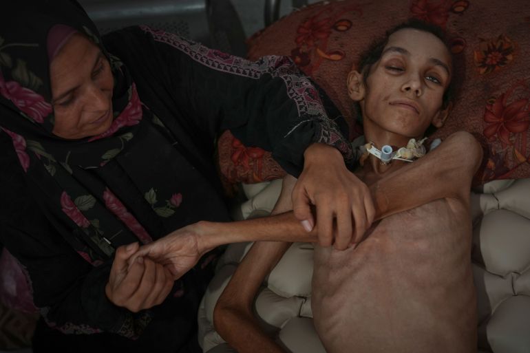 Shahinaz al-Dibs cares for her 14-year-old son, Mosab, at Shifa Hospital in Gaza City, Thursday, July 31, 2025. He is largely paralyzed and only partly conscious after suffering a serious head injury on May 7 when an airstrike hit near their tent, and is now malnourished due to the hospital’s lack of supplements and nutrient formula. (AP Photo/Jehad Alshrafi)