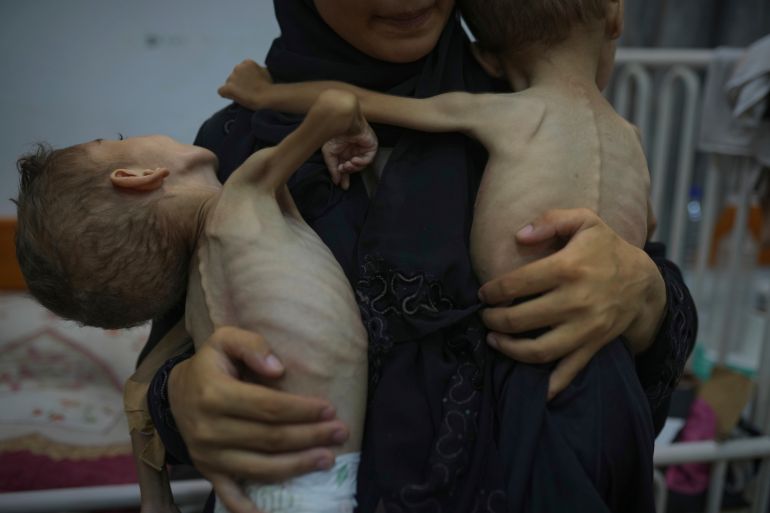 Omniya Mahra, holds shirtless for a photo her sons Oday, 4, left, and Mohammed, 3, who suffer from malnutrition and a genetic nerve disorder, at the Friends of the Patient Hospital in Gaza City, Tuesday, July 29, 2025. In Gaza, malnutrition is often worsened by preexisting conditions and compounded by illnesses linked to inadequate health care and poor sanitation, largely the result of the ongoing war. (AP Photo/Jehad Alshrafi)