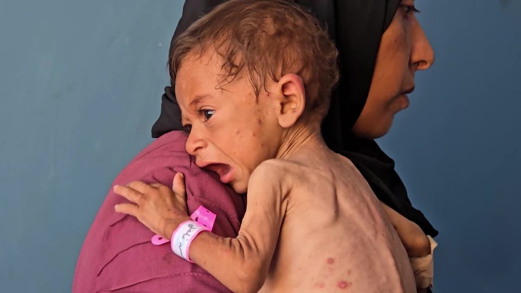 أسئلة المجوعين في غزة للعالم والعرب