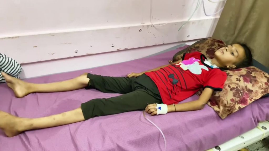 “غيلان باريه” ينهك أجساد أطفال غزة وتفاعلات واسعة بمنصات التواصل | أخبار