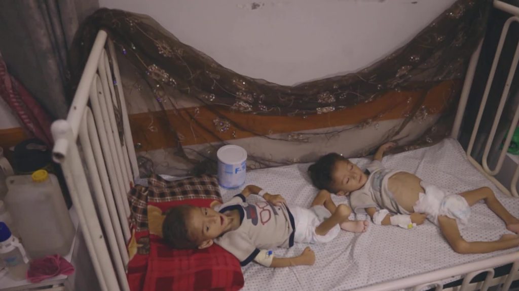 تفاقم المجاعة يضاعف معاناة عائلة غزية فما قصتها؟