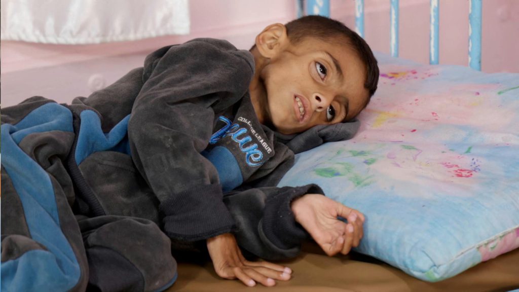 إسرائيل تمنع التمر والبطاطا من دخول غزة..كيف يؤثر ذلك على صحة الغزيين؟