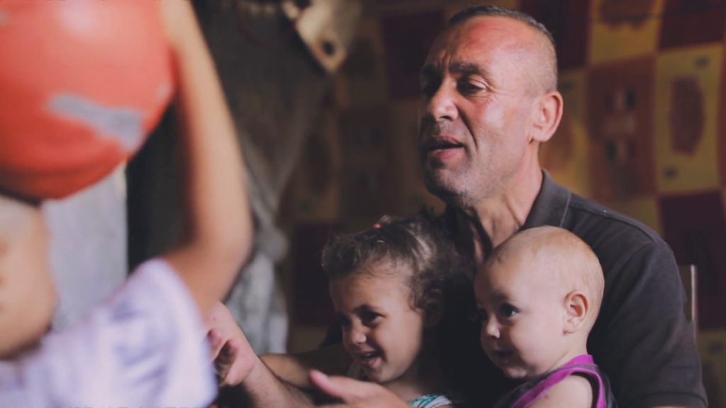 لماذا نرى صورا لأطفال في غزة عندهم “كرش” رغم المجاعة؟ | صحة