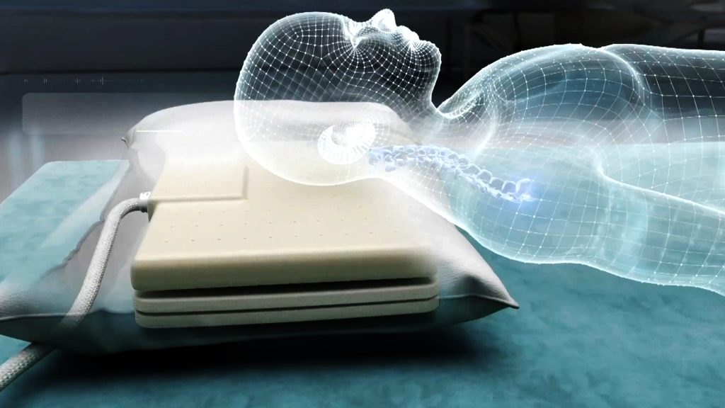 اضطراب أنماط النوم لدى مرضى قصور القلب يضاعف خطر الانتكاسات