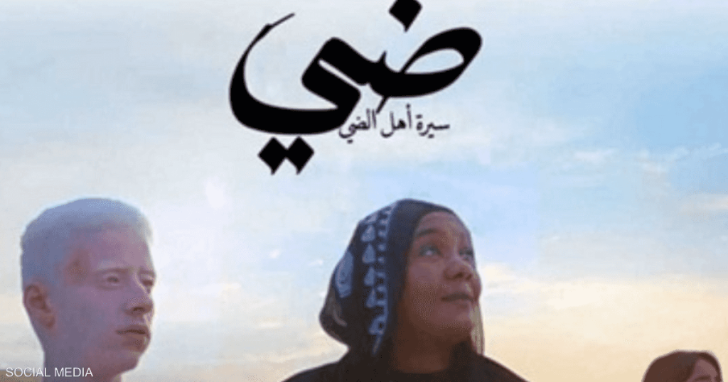 مصر.. فيلم ضي يتناول مرض “الألبينو” بمشاركة محمد منير