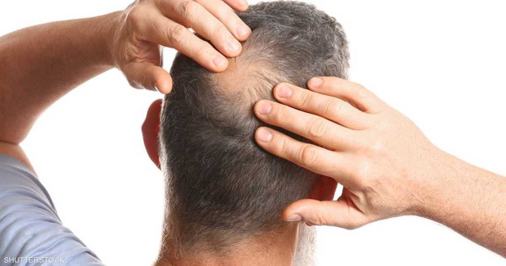 زيت بذور اليقطين.. حل طبيعي لتساقط الشعر ولكن ليس للجميع