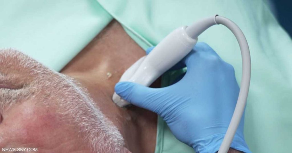 فحص بسيط يكشف خطر الإصابة بالنوبات القلبية والسكتات الدماغية