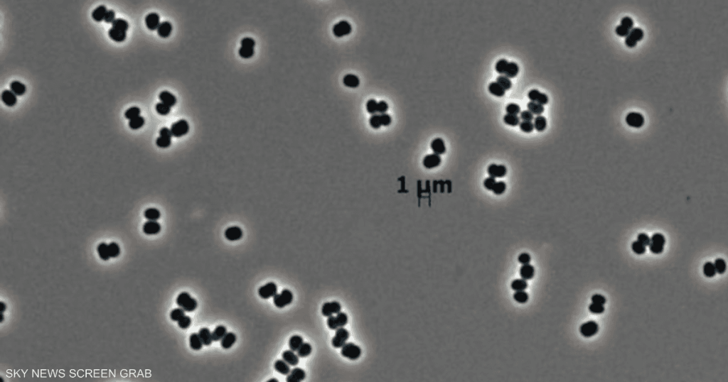 حتى في بيئة معقمة.. اكتشاف بكتيريا قادرة على التظاهر بالموت