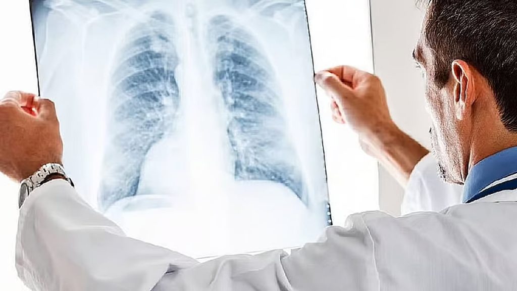 سعود الطبية توضح الفرق بين الورم الحميد والسرطاني