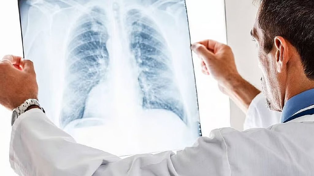 طبيب: اتخاذ نمط حياة صحي يقي من الأمراض بنسبة 80%