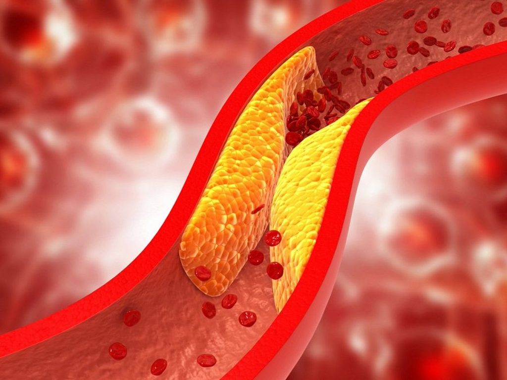 استشاري: علاج الكوليسترول المبكر أكثر فاعلية من تأخيره لما بعد الخمسين