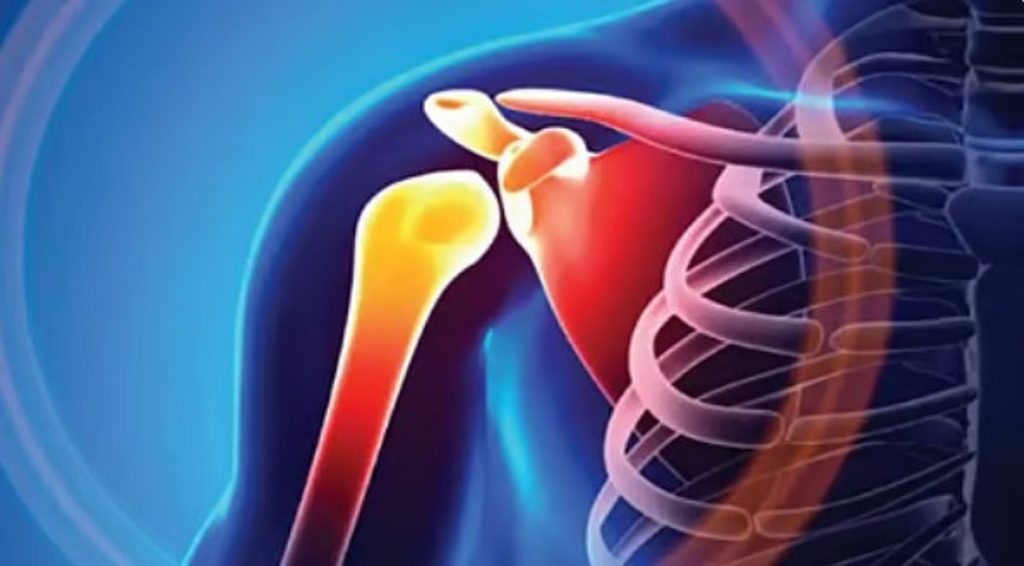 استشارية: الإفراط في الكافيين يزيد خطر الإصابة بهشاشة العظام