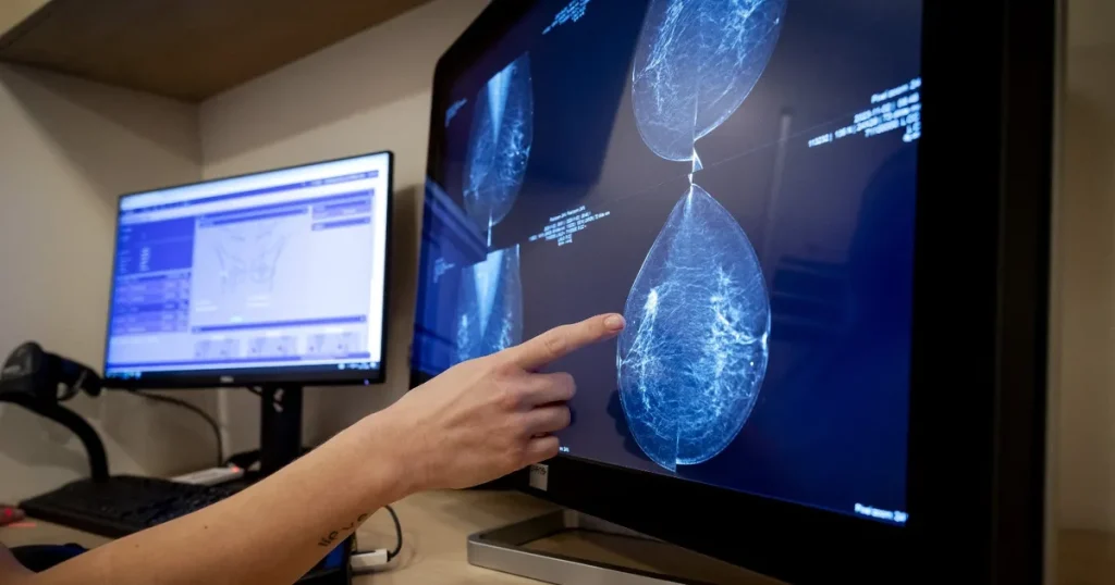 الإجهاض السابق لا يزيد خطر الإصابة بسرطان الثدي